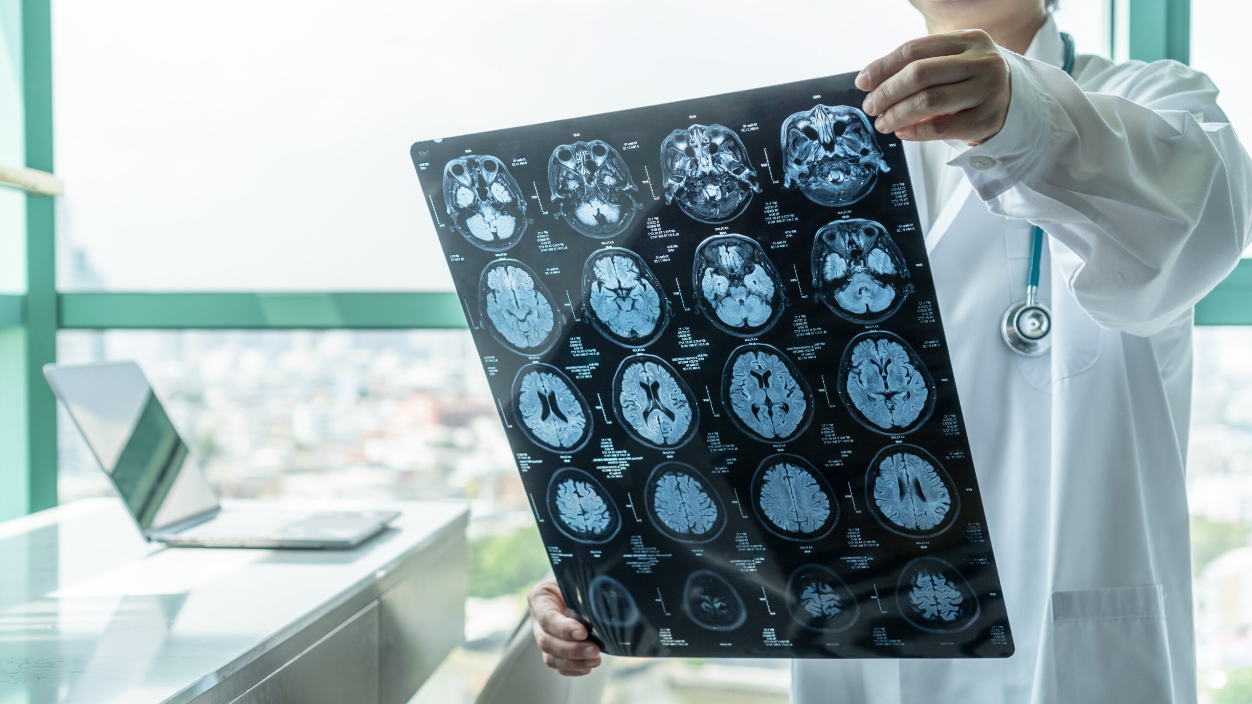 Doctor reviewing an MRI scan with an adult patient